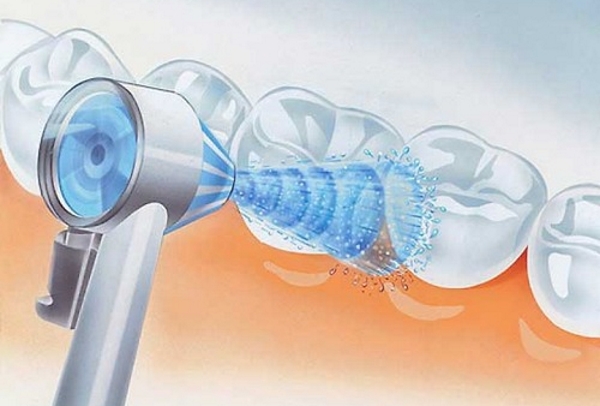 Microbubble model Micro Bubble Irrigator