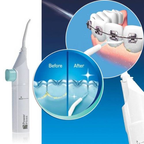 Cleaning braces with irrigator: before and after Cleaning braces with irrigator: before and after
