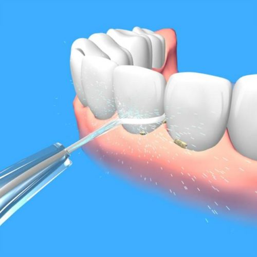 Water pressure on teeth Water pressure on teeth