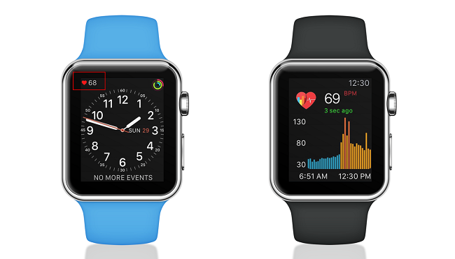 Cardiogram